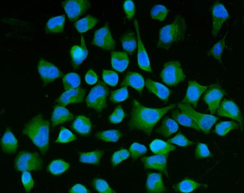 Semaphorin 3B/SEMA3B Mouse Monoclonal Antibody