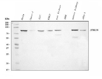 Semaphorin 3B/SEMA3B Mouse Monoclonal Antibody