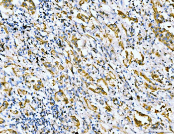 Filamin B/FLNB Mouse Monoclonal Antibody