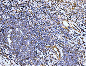 Filamin B/FLNB Mouse Monoclonal Antibody