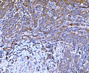 Filamin B/FLNB Mouse Monoclonal Antibody
