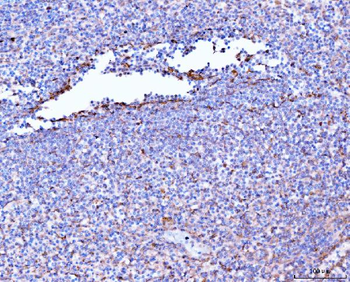 Filamin B/FLNB Mouse Monoclonal Antibody