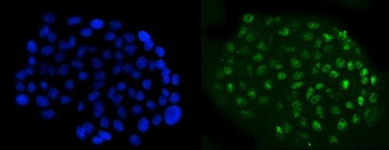 NFIB/NF1B2 Mouse Monoclonal Antibody