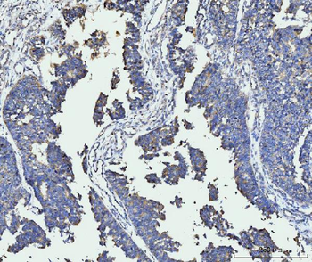 FACL4/ACSL4 Mouse Monoclonal Antibody