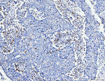 FACL4/ACSL4 Mouse Monoclonal Antibody