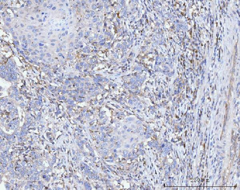 FACL4/ACSL4 Mouse Monoclonal Antibody