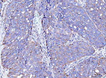 FACL4/ACSL4 Mouse Monoclonal Antibody