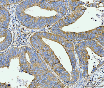 FACL4/ACSL4 Mouse Monoclonal Antibody