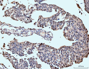 Neurofibromin/NF1 Mouse Monoclonal Antibody