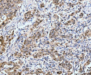 Neurofibromin/NF1 Mouse Monoclonal Antibody
