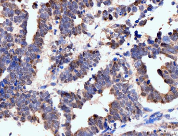 Neurofibromin/NF1 Mouse Monoclonal Antibody
