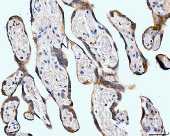 Neurofibromin/NF1 Mouse Monoclonal Antibody