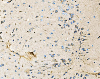 Neurofibromin/NF1 Mouse Monoclonal Antibody