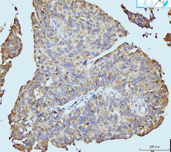 Neurofibromin/NF1 Mouse Monoclonal Antibody