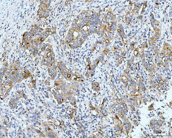 Neurofibromin/NF1 Mouse Monoclonal Antibody