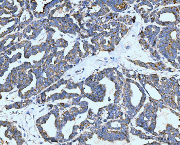 Neurofibromin/NF1 Mouse Monoclonal Antibody