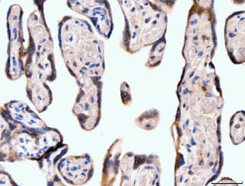 Neurofibromin/NF1 Mouse Monoclonal Antibody