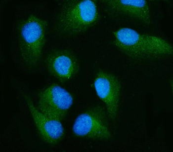 RALBP1 Mouse Monoclonal Antibody