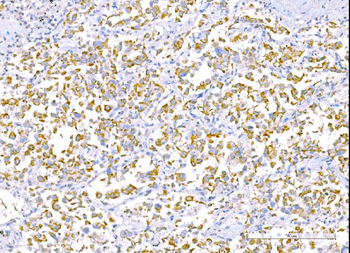 RALBP1 Mouse Monoclonal Antibody