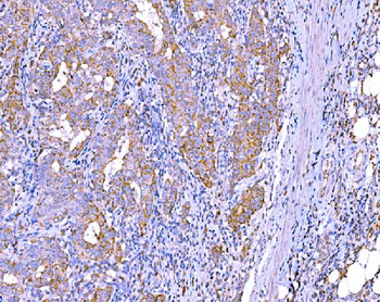 RALBP1 Mouse Monoclonal Antibody