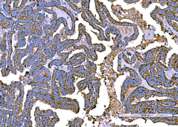 RALBP1 Mouse Monoclonal Antibody