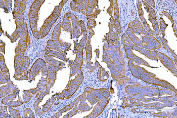RALBP1 Mouse Monoclonal Antibody