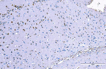 RALBP1 Mouse Monoclonal Antibody