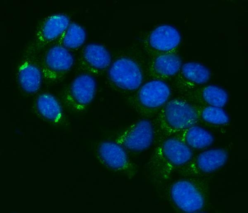 P Glycoprotein/ABCB1 Rabbit Polyclonal Antibody