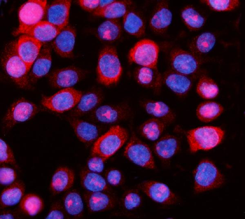 Aurora A/AURKA Rabbit Polyclonal Antibody