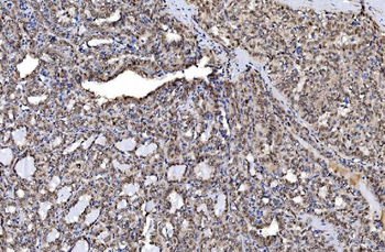 Aurora A/AURKA Rabbit Polyclonal Antibody