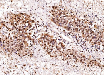 Aurora A/AURKA Rabbit Polyclonal Antibody
