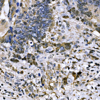 BUB1 Rabbit Polyclonal Antibody