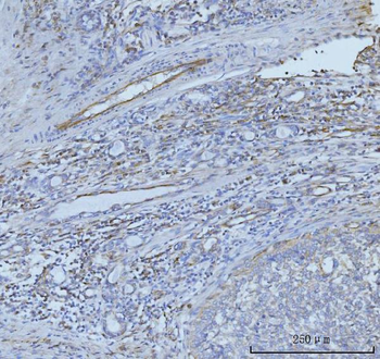 CD93 Rabbit Polyclonal Antibody