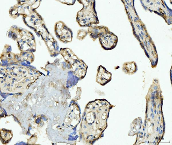 CD93 Rabbit Polyclonal Antibody