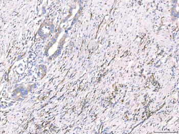 CD93 Rabbit Polyclonal Antibody