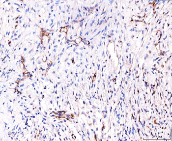 CD93 Rabbit Polyclonal Antibody