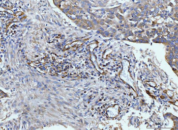 CD93 Rabbit Polyclonal Antibody