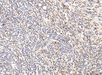 CD93 Rabbit Polyclonal Antibody