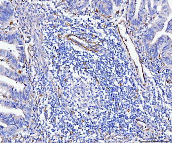 CD93 Rabbit Polyclonal Antibody