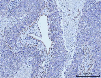 CD93 Rabbit Polyclonal Antibody