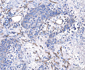 CD93 Rabbit Polyclonal Antibody
