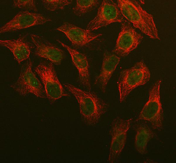 CDT1/DUP Rabbit Polyclonal Antibody