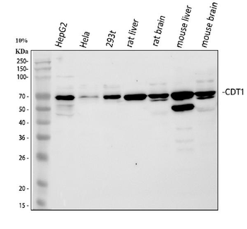 CDT1/DUP Rabbit Polyclonal Antibody