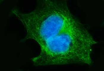 FGFR3 Rabbit Polyclonal Antibody