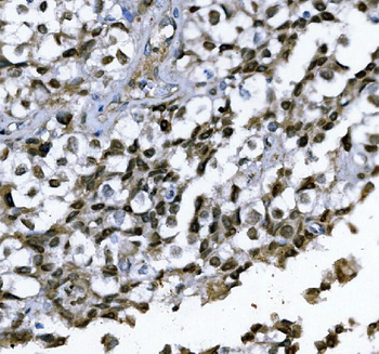 GATA1 Rabbit Polyclonal Antibody