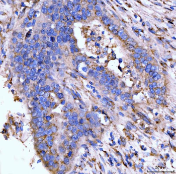 Giantin/GOLGB1 Rabbit Polyclonal Antibody