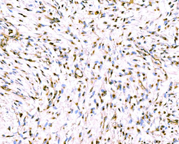 Giantin/GOLGB1 Rabbit Polyclonal Antibody