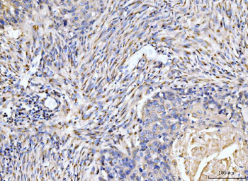 Giantin/GOLGB1 Rabbit Polyclonal Antibody