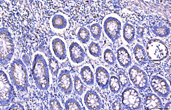 Giantin/GOLGB1 Rabbit Polyclonal Antibody