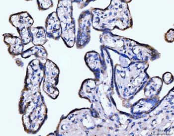 Giantin/GOLGB1 Rabbit Polyclonal Antibody